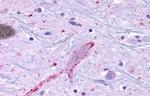 MRGPRF Antibody in Immunohistochemistry (Paraffin) (IHC (P))