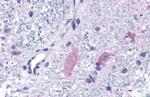 MRGPRF Antibody in Immunohistochemistry (Paraffin) (IHC (P))