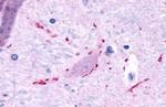 MRGPRF Antibody in Immunohistochemistry (Paraffin) (IHC (P))