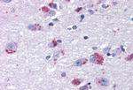 MRGPRX2 Antibody in Immunohistochemistry (Paraffin) (IHC (P))