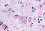MRGPRX3 Antibody in Immunohistochemistry (Paraffin) (IHC (P))