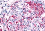 MRGPRX4 Antibody in Immunohistochemistry (Paraffin) (IHC (P))