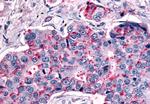 MRGPRX4 Antibody in Immunohistochemistry (Paraffin) (IHC (P))
