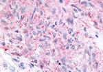 MRGPRX4 Antibody in Immunohistochemistry (Paraffin) (IHC (P))
