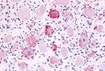 MRGPRX4 Antibody in Immunohistochemistry (Paraffin) (IHC (P))