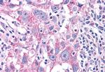 NEK6 Antibody in Immunohistochemistry (Paraffin) (IHC (P))