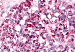 NEK7 Antibody in Immunohistochemistry (Paraffin) (IHC (P))