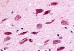 NEK9 Antibody in Immunohistochemistry (Paraffin) (IHC (P))