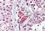NEK9 Antibody in Immunohistochemistry (Paraffin) (IHC (P))