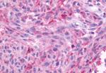 NMBR Antibody in Immunohistochemistry (Paraffin) (IHC (P))