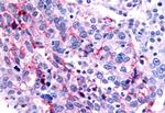 NR0B2 Antibody in Immunohistochemistry (Paraffin) (IHC (P))