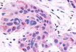 NR0B2 Antibody in Immunohistochemistry (Paraffin) (IHC (P))