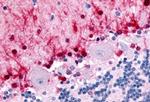 NR1D2 Antibody in Immunohistochemistry (Paraffin) (IHC (P))