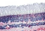 PNR Polyclonal Antibody