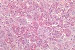 NR5A1 Antibody in Immunohistochemistry (Paraffin) (IHC (P))
