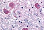 NTSR2 Antibody in Immunohistochemistry (Paraffin) (IHC (P))