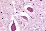 NTSR2 Antibody in Immunohistochemistry (Paraffin) (IHC (P))