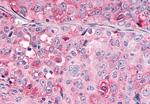 OR10R2 Antibody in Immunohistochemistry (Paraffin) (IHC (P))