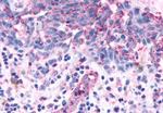 OR2A4 Antibody in Immunohistochemistry (Paraffin) (IHC (P))