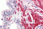 OR51E1 Antibody in Immunohistochemistry (Paraffin) (IHC (P))
