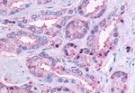 OR51E1 Antibody in Immunohistochemistry (Paraffin) (IHC (P))