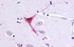 OR51E1 Antibody in Immunohistochemistry (Paraffin) (IHC (P))
