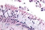 OR6K3 Antibody in Immunohistochemistry (Paraffin) (IHC (P))
