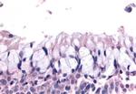 OR6K3 Antibody in Immunohistochemistry (Paraffin) (IHC (P))