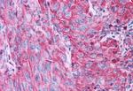 P2Y4 Antibody in Immunohistochemistry (Paraffin) (IHC (P))