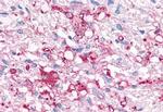P2Y6 Antibody in Immunohistochemistry (Paraffin) (IHC (P))