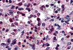 P2Y6 Antibody in Immunohistochemistry (Paraffin) (IHC (P))