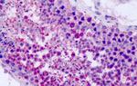 P2Y8 Antibody in Immunohistochemistry (Paraffin) (IHC (P))
