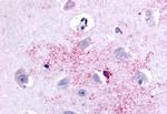 PAK6 Antibody in Immunohistochemistry (Paraffin) (IHC (P))