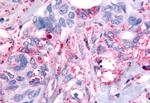 PAK6 Antibody in Immunohistochemistry (Paraffin) (IHC (P))