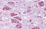 NPY4R Antibody in Immunohistochemistry (Paraffin) (IHC (P))