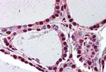 Prokineticin Receptor 2 Antibody in Immunohistochemistry (Paraffin) (IHC (P))