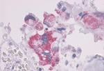 PTH1R Antibody in Immunohistochemistry (Paraffin) (IHC (P))
