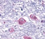 PTH2R Polyclonal Antibody