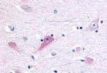 RORB Antibody in Immunohistochemistry (Paraffin) (IHC (P))