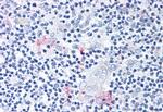 ROR gamma Polyclonal Antibody