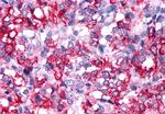 RXFP2 Antibody in Immunohistochemistry (Paraffin) (IHC (P))