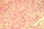 RXFP2 Antibody in Immunohistochemistry (Paraffin) (IHC (P))