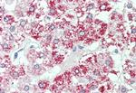 SLC7A2 Antibody in Immunohistochemistry (Paraffin) (IHC (P))