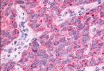 TAOK1 Antibody in Immunohistochemistry (Paraffin) (IHC (P))