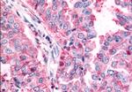 TAOK1 Antibody in Immunohistochemistry (Paraffin) (IHC (P))