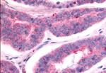 TAOK1 Antibody in Immunohistochemistry (Paraffin) (IHC (P))