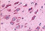 TAOK1 Antibody in Immunohistochemistry (Paraffin) (IHC (P))