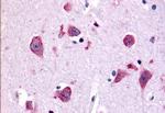 TAOK1 Antibody in Immunohistochemistry (Paraffin) (IHC (P))