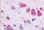 TAOK1 Antibody in Immunohistochemistry (Paraffin) (IHC (P))