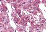 TM9SF1 Antibody in Immunohistochemistry (Paraffin) (IHC (P))